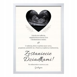 INFORMACJA O CIĄŻY PLAKAT Z RAMKĄ A4 dla DZIADKÓW ZDJĘCIE USG PAMIĄTKA